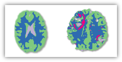 Diffusion kurtosis visualization publication image