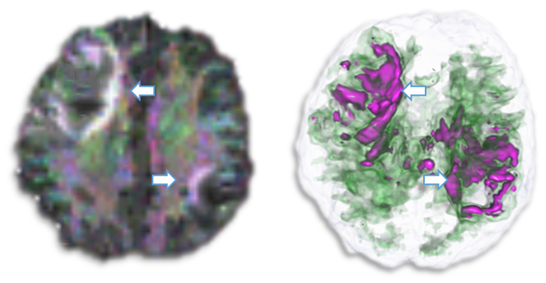 Brain microstructure visualization publication image
